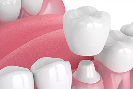 An illustration of a collection of white teeth with pink gums, set against a white background.