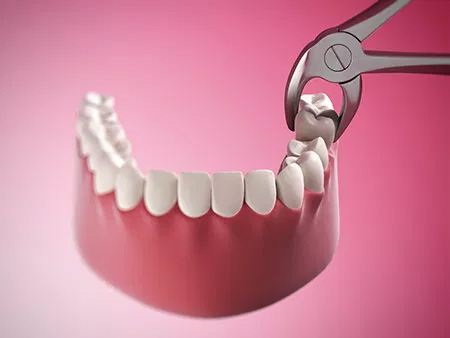 The image shows a pair of scissors cutting into a dental implant with a visible crown, set against a pink background.